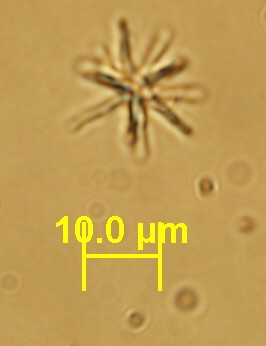 Tethya citrina aster5b