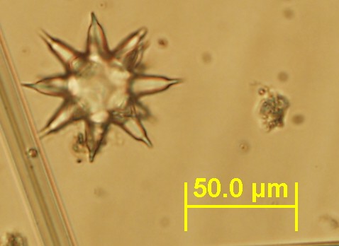 Tethya citrina aster6b